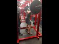 Weight lifting 1 complication