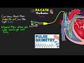 The BASICS of the Pulmonary Artery Catheter