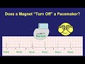 Living With A Pacemaker (common questions answered) - in Plain English!
