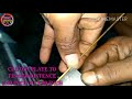 How To Clutch Finger Setting 15 Inch Ashok Leyland 2518, By ITI Mechanical