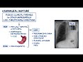 Approach to chest pain: Clinical sciences