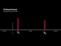 S3 vs S4 Heart Sound