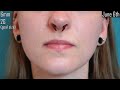 SEPTUM STRETCHING from 1,6mm to 6mm (14g to 2g)