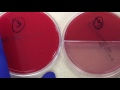 Plate Reading - Urine I