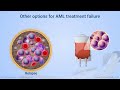 Treatment Failure and Relapse in Acute Myeloid Leukemia (AML)