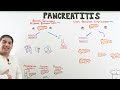 Pancreatitis | Clinical Medicine