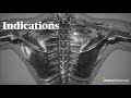 Ultrasound guided thoracic paravertebral block