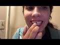 MY RETAINER AND HOW TO ON WHITENING MY TEETH!!!