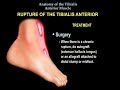 Anatomy Of The Tibialis Anterior Muscle - Everything You Need To Know - Dr. Nabil Ebraheim