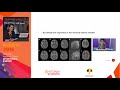 EP. 13 | DBS – FROM REFERRAL TO OUTCOME | Prof. Marwan Hariz & Dr. Laura Cif | DDAYS 2018