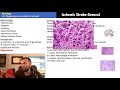 High Yield Neurology Review for USMLE and COMLEX with Dr. R