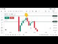 Candlestick पैटर्न करोड़पति बनायेगा | candlestick pattern for intraday trading