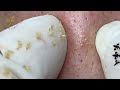 Satisfying Relaxing with Sac Dep Spa Video (#106)