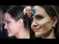 Angelina Jolie NEW FACE | Plastic Surgery Analysis