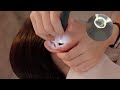 Ear Cleaning While Watching ASMR 👂| Endoscope, Cutter, Peacock Feather, Cotton | Visual Ear Cleaning