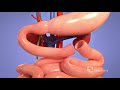 Medical Animation: Living Donor Liver Transplant | Cincinnati Children's