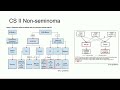 Retroperitoneal Lymph Node Dissection for Testicular Cancer