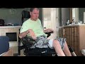 Quadriplegic using a leg bag concealed under shorts