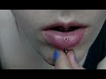 vertical labret - hole - scar tissue [I don't have this piercing anymore!]]