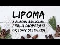 LIPOMA - 3 ALASAN BENJOLAN PERLU DIOPERASI