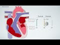Heart murmurs for beginners 🔥 🔥 🔥 Part 1:Aortic & Mitral stenosis, Aortic & mitral regurgitation.