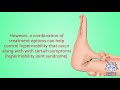 Hypermobility (joints), Causes, Signs and Symptoms, Diagnosis and Treatment.