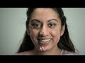 Dr. Emma Treats A Patient With An Extremely Rare Skin Condition | The Bad Skin Clinic