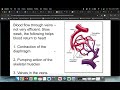 Unit 9 Obj 3 A & P Blood Vessels