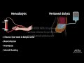 Renal Replacement Therapy: Hemodialysis vs Peritoneal Dialysis, Animation