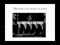 Point of Care Echo: Stroke Volume Determination