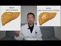 Eating Eggs and Beef Liver to Reverse Fatty Liver