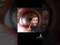 How Your Eyes Can Hold The Answers To Unlocking Your Health - IRIDOLOGY