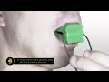 Jaw Exerciser Using Guide (How to Use Jaw Exerciser)