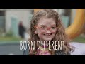 The Girl Born Without A Nose | BORN DIFFERENT