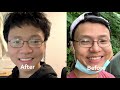 Zimba Teeth Whitening Strips | Before & After