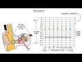 Understanding Audiometry and Audiograms