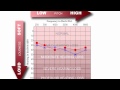 How to Read an Audiogram