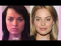 Margot Robbie: From Natural Beauty to Plastic Surgery Perfection