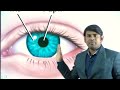4.Eye Basic Structure in Hindi, Biology in Hindi by Nitin Sir Study91, Eye Related Question Answer