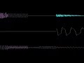 Vortex - LMAN (ZylX050V2 Cover)