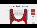 Hemodialysis Kinetics 101 08 Access Recirculation