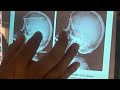 radiology anatomy | upper limb x ray anatomy viva | thorax x-ray anatomy practical | skull radiology