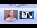 Improve Tinnitus With Simple Posture Exercises