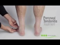 Peroneal Tendonitis: Causes, Diagnosis, and Treatment