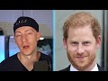 Prince Harry's Hair Transplant | Plastic Surgery Analysis