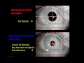 Light-induced Tearing and Post-illumination Pupil Response