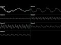 Sonic CD - Palmtree Panic Zone Past - Oscilloscope Deconstruction