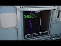 A320 new radio system | DRAIMS