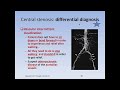 Lumbar Spinal Stenosis, Cauda Equina Syndrome, Sciatica, & Disc Herniation: An Advanced Lecture.