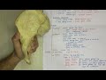 hip bone anatomy 3d | ilium bone anatomy | bones of lower limb anatomy